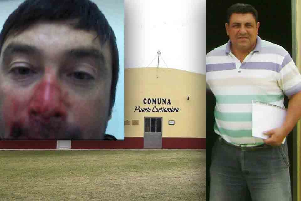 Intendente lo golpeó por salir de la casa en cuarentena